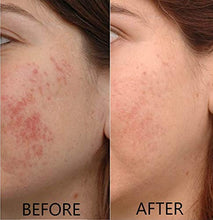 Load image into Gallery viewer, Vitamin C Serum 20% Pure L-Ascorbic Acid, Ferulic Acid, Vitamin E and Hyaluronic Acid for Face and Eyes Natural Anti Aging Anti Wrinkle 1oz. by Dr. Brenner (1 oz)
