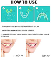 Load image into Gallery viewer, V-White Electric Toothbrush Adults - Ultrasonic U-Shaped Toothbrushes for Teeth Whitening - 360° Mouth Cleansing, Hands free Gums Protection - Wireless Charging &amp; LED Light - Waterproof IPX7 Certified

