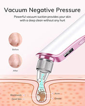 Load image into Gallery viewer, AEVO Blackhead Remover Vacuum, Electric Facial Pore Removal Extractor Kit with 5 Replaceable Heads, [Adjustable Suction] [LED Display] [USB Rechargeable], Beauty Device for Skin Treatment
