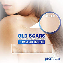 Load image into Gallery viewer, Premium Advanced Scar Gel Medical-Grade Silicone for Face, Body, Stretch Marks, C-Sections, Surgical, Burn, Acne | Old &amp; New Scars, Clinically Proven | 30g
