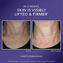 Load image into Gallery viewer, RoC Crepe Repair Anti Aging Daily Face Moisturizer &amp; Neck Firming Cream (1.7 oz) + RoC Retinol Wrinkle Smoothing Capsules (7 CT), Skin Care Treatment
