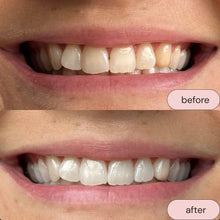 Load image into Gallery viewer, Smile Hero Purple Toner Teeth Whitener, Effortless at Home Teeth Whitener, Tooth Stain Remover, Purple Toothpaste, Safe &amp; Zero Sensitivity Brightening
