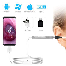 Load image into Gallery viewer, Ear Specula Set for ScopeAround/Anykit Digital Otoscope Ear Wax Removal Camera, Bag of 100 Pices
