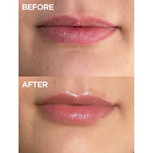Load image into Gallery viewer, Lanolips 101 Ointment Multipurpose Superbalm Strawberry - Non-Greasy &amp; Natural Salve with Lanolin for Chapped Lips, Dry Skin Patches &amp; Cuticles - Non-Petroleum Based Balm Alternative (10g / 0.35oz)
