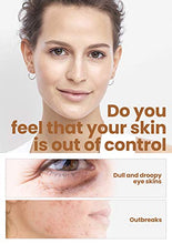 Load image into Gallery viewer, HOPEMATE Natural Facial Retinol Serum with Hyaluronic Acid&amp; Vitamin E, New Skin Treatment Formula, Organic Anti Wrinkle Reducer, Anti Aging Moisturizer, Dark Circles, Scar, Sun Damage Corrector
