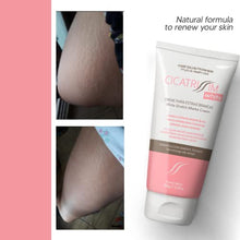 Load image into Gallery viewer, Cicatrissim White Stretch Mark Fade and Removal Cream - Tummy Butter for Pregnancy Belly, Weight Change and Growth Spurts - Stretch Marks Remover for Pregnant Mothers - With Natural Ingredients
