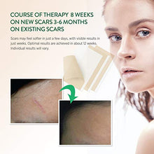 Load image into Gallery viewer, Aroamas, Silicone Scar Removal Sheets - for Keloid, C-Section, Hypertrophic, Surgical Scars and More Reusable and Washable 3"×1.57", 4 Sheets (2 Month Supply)
