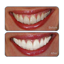 Load image into Gallery viewer, Go Smile Premium 2-In-1 Teeth Whitening System: Electric Tooth Brush+Teeth Whitening Gel For Healthier &amp; Brighter Teeth | Instant Results, Safe On Dental Work, Crowns, Veneers, Bonding+More (Silver)
