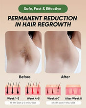 Load image into Gallery viewer, XSOUL At-Home IPL Hair Removal for Women and Men Permanent Hair Removal 500,000 Flashes Painless Hair Remover on Armpits Back Legs Arms Face Bikini Line, Corded
