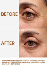 Load image into Gallery viewer, HOPEMATE Natural Facial Retinol Serum with Hyaluronic Acid&amp; Vitamin E, New Skin Treatment Formula, Organic Anti Wrinkle Reducer, Anti Aging Moisturizer, Dark Circles, Scar, Sun Damage Corrector
