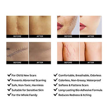 Load image into Gallery viewer, AZALLY Advanced Scar Gel - Scar Diminishing Serum - Reduces the Appearance of Old &amp; New Scars - Best Scar Treatment for Repair Scars from Burns Cuts Acne Spots Stretch Marks - 1oz. 

