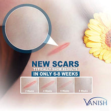 Load image into Gallery viewer, Vanish Silicone Scar Gel Medical-Grade Silicone Cream for Face, Body, Stretch Marks, C-Sections, Surgical, Burn, Acne | Old &amp; New Scars, Clinically Proven | 30g
