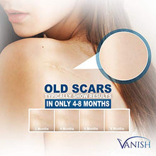 Load image into Gallery viewer, Vanish Silicone Scar Gel Medical-Grade Silicone Cream for Face, Body, Stretch Marks, C-Sections, Surgical, Burn, Acne | Old &amp; New Scars, Clinically Proven | 30g
