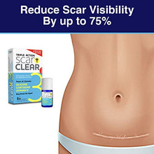 Load image into Gallery viewer, ScarClear Triple Action Scar Treatment .5oz
