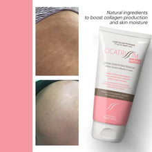 Load image into Gallery viewer, Cicatrissim White Stretch Mark Fade and Removal Cream - Tummy Butter for Pregnancy Belly, Weight Change and Growth Spurts - Stretch Marks Remover for Pregnant Mothers - With Natural Ingredients
