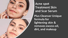 Load image into Gallery viewer, Acne spot Treatment Skin Serum Vitamin C, E and niacin amide Vitamin B3, B5, Acscanex for scars remove 50ML plus Face Cleanser 120Ml FREE
