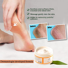 Load image into Gallery viewer, STRIDE Foot Cream Smoothes Rough &amp; Dry Skin –– Dematologist-Developed, Intensely Moisturizing Foot Cream with Aloe Vera, Coconut oil and Green tea
