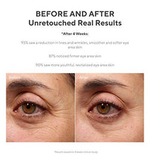 Load image into Gallery viewer, Murad Retinol Youth Renewal Eye Serum, 0.5 Fl Oz

