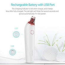 Load image into Gallery viewer, Blackhead Remover Vacuum - Xpreen Face Vacuum Pore Cleanser, Pore Vacuum Rechargeable Black Head Suctioner Removel Tool, Blackhead Vacume with 4 Adjustable Suction Porbes, Pore Vaccume for Face Care

