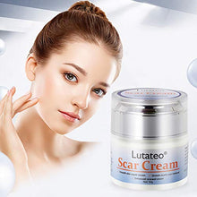 Load image into Gallery viewer, Scar Cream, Stretch Mark Cream, Acne Scar Removal Cream, Acne Spots Treatment, Burns Repair, Face Skin Repair Cream(50g)
