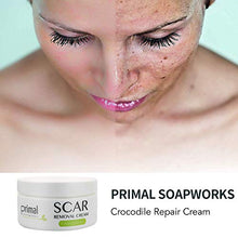 Load image into Gallery viewer, Scar Removal Cream For Old Scars -Stretch Mark Removal Cream for Men and Women Stretch Marks Relief and Burns Repair,Face Skin Repair Cream
