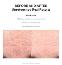 Load image into Gallery viewer, Murad Resurgence Retinol Youth Renewal Serum - Anti-Aging Serum for Lines and Wrinkles -Retinol Serum for Face and Neck - Youth Serum for Smoother Skin, 1.0 Fl Oz (Packaging may Vary)
