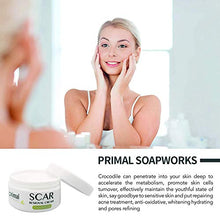 Load image into Gallery viewer, Scar Removal Cream For Old Scars -Stretch Mark Removal Cream for Men and Women Stretch Marks Relief and Burns Repair,Face Skin Repair Cream
