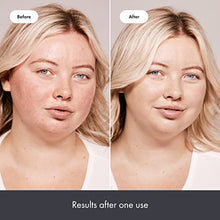 Load image into Gallery viewer, Rescue Balm +Red Correct Post-Blemish Recovery Cream from Hero Cosmetics - Intensive Nourishing and Calming for Dry, Red-Looking Skin After a Blemish - Dermatologist Tested and Vegan-Friendly (0.507 fl. oz)

