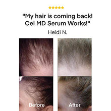 Load image into Gallery viewer, Cel Microstem Healthy Hair Growth Serum – Anti Thinning Hair Oil – Biotin Hair Serum - Thicker, Healthier Hair for Men &amp; Women

