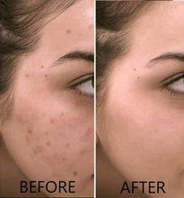 Load image into Gallery viewer, Vitamin C Serum 20% Pure L-Ascorbic Acid, Ferulic Acid, Vitamin E and Hyaluronic Acid for Face and Eyes Natural Anti Aging Anti Wrinkle 1oz. by Dr. Brenner (1 oz)
