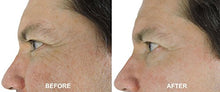 Load image into Gallery viewer, ANTI-AGING- MAGIC DMAE+MSM+NIACIN Firming Cream, 100% Pure Hyaluronic Acid, Argireline, Matrixyl 3000
