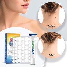 Load image into Gallery viewer, Pureskin Safe &amp; Effective Formula Skin Tag Remover Patches Set, Skin Tag Removal Patches Set with Natural Ingredients for Your Skin Tag
