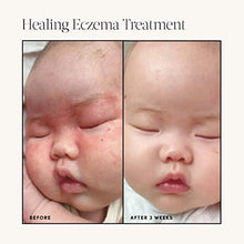Load image into Gallery viewer, Evereden Healing Eczema Treatment, 1.7 fl oz | Plant Based and Naturally Derived Eczema Cream | Clean and Fragrance Free Eczema Cream for Babies, Kids, and Adults
