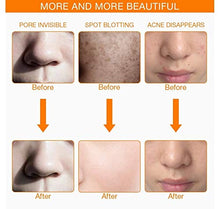 Load image into Gallery viewer, 7 Color Facial Mask | Photon Face Skin Care System | Healthy Smooth Skin Rejuvenation | Anti-Aging, Tightening, Toning, Wrinkle Acne Treatment | Collagen Restoring &amp; Whitening Device
