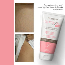 Load image into Gallery viewer, Cicatrissim White Stretch Mark Fade and Removal Cream - Tummy Butter for Pregnancy Belly, Weight Change and Growth Spurts - Stretch Marks Remover for Pregnant Mothers - With Natural Ingredients
