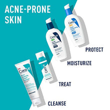 Load image into Gallery viewer, CeraVe Retinol Serum for Post-Acne Marks and Skin Texture | Pore Refining, Resurfacing, Brightening Facial Serum with Retinol | Fragrance Free &amp; Non-Comedogenic| 1 Oz
