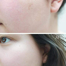 Load image into Gallery viewer, Fovely 30ml AHA 30% + BHA 2% Peeling Solution 10-Minute Exfoliating Face Brighten Serum Face Skin Care for Sensitive Skin

