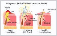 Load image into Gallery viewer, Sulfur Soap for Acne Pharmaceutical Grade Dermatologists FDA Approved for Acne Rosacea 100G
