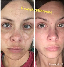 Load image into Gallery viewer, Potent Dark Spot Corrector Remover For Face &amp; Retinol Cream Provides the Most Effective Combination For Fading &amp; Removing Dark Spots
