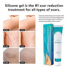 Load image into Gallery viewer, Aroamas Silicone Scar Gel, 45g, Silicone Scar Gel for Surgical Scars, for Face, Scar gel with silicone for Keloids, C-Section, Cosmetic Procedures, Burns, Injuries
