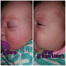 Load image into Gallery viewer, BabyBiotics - Topical Probiotic Body Care for CHILDREN of ALL AGES 4oz -Hypoallergenic, Vegan, Non GMO, GF, 100% Natural Live Probiotic Patented, External + Internal Use,Totally Safe, No Refrigeration
