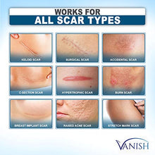 Load image into Gallery viewer, Vanish Silicone Scar Gel Medical-Grade Silicone Cream for Face, Body, Stretch Marks, C-Sections, Surgical, Burn, Acne | Old &amp; New Scars, Clinically Proven | 30g
