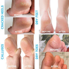 Load image into Gallery viewer, Tea Tree Oil Foot Balm, 100% All Natural Moisturizing Fast Acting Cream For Dry Feet &amp; Cracked Heels, Extra Strength Callus Remover for Itchy Feet, Toenail Treatment, Calluses Remover &amp; Callus Shaver
