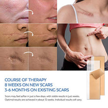 Load image into Gallery viewer, KRONA Medical Silicone Scar Removal Sheets [Set of 5] - Fast &amp; Effective on Keloid, Surgery, Burn, Acne, C-Section Scars
