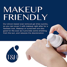 Load image into Gallery viewer, Scar Remover Gel for Scars from C-Section, Stretch Marks, Acne, Surgery, Effective for both Old and New Scars
