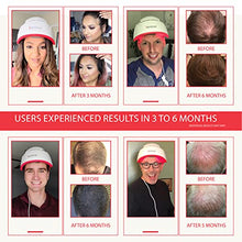 Load image into Gallery viewer, iRestore Professional Laser Hair Growth System - FDA Cleared Laser Hair Loss Treatments for Women and Hair Regrowth for Men with Balding, Thinning Hair
