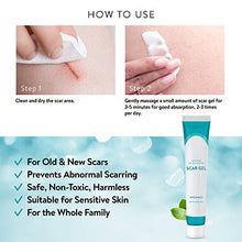 Load image into Gallery viewer, Aroamas Silicone Scar Gel, 45g, Silicone Scar Gel for Surgical Scars, for Face, Scar gel with silicone for Keloids, C-Section, Cosmetic Procedures, Burns, Injuries
