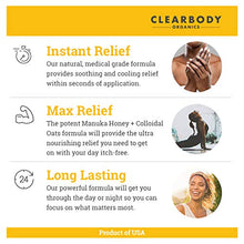Load image into Gallery viewer, Eczema Psoriasis Cream for Dry Itchy Cracked Irritated Skin- Manuka Honey &amp; Colloidal Oatmeal Treatment for Dermatitis, Shingles, Acne, Rosacea- Natural Anti-itch Relief for Kids, Adults, Baby Eczema

