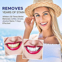 Load image into Gallery viewer, NOVOME Teeth Whitening Pen(2 Pcs), 20+ Uses, Effective &amp; Painless, No Sensitivity, Travel-Friendly, Easy to Use, Natural Mint Flavor: Smile with Confidence, Beautiful White Smile!
