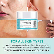 Load image into Gallery viewer, Scar Removal Cream, Scar Cream For Old Scars - Stretch Mark Removal Cream for Men &amp; Women - Stretch Marks Relief and Burns Repair, Face Skin Repair Cream
